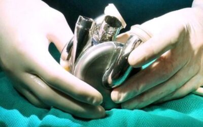 Implantan primer corazón artificial de larga duración del mundo