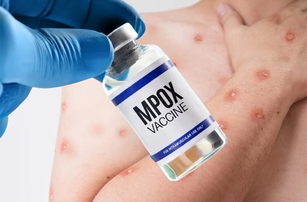 Preparan condiciones en RDC para iniciar vacunación contra Mpox