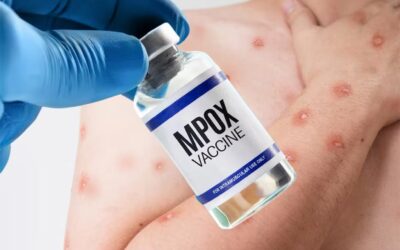 Preparan condiciones en RDC para iniciar vacunación contra Mpox