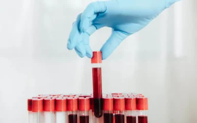 ¿Cada cuánto tiempo hay que hacerse un análisis de sangre?