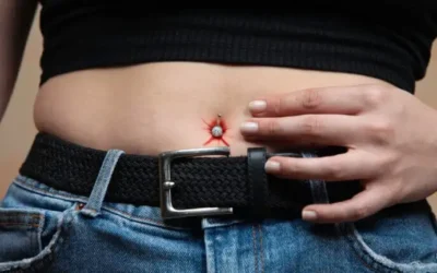 Piercing del ombligo infectado: síntomas, causas y cómo curarlo