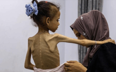 ONU declarará oficialmente hambruna en Gaza por 1.ª vez